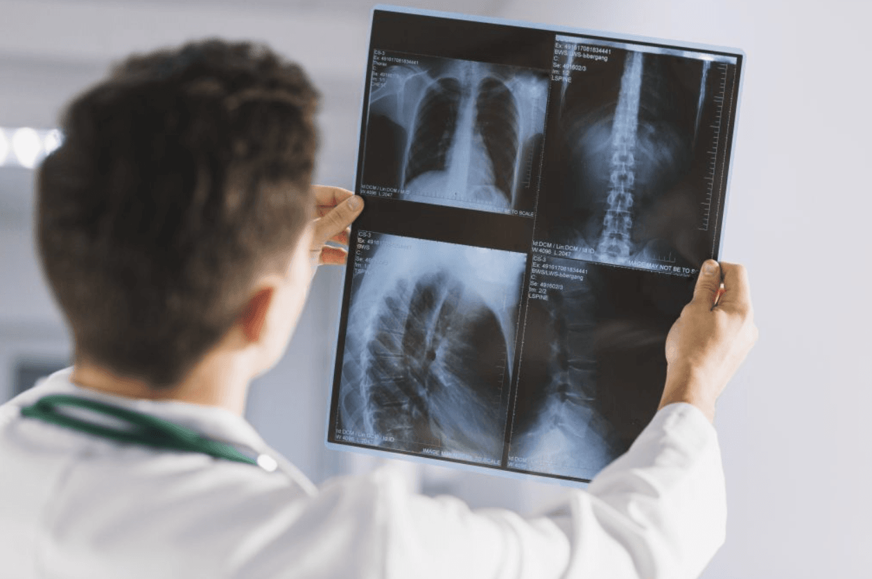 profissional de radiologia analisando.png